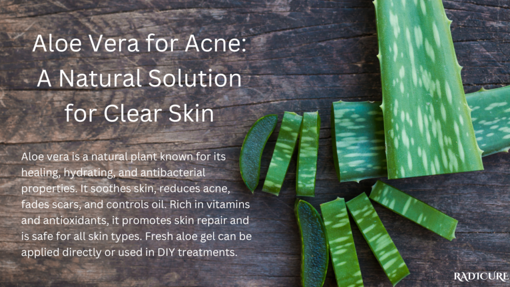 aloe vera for acne