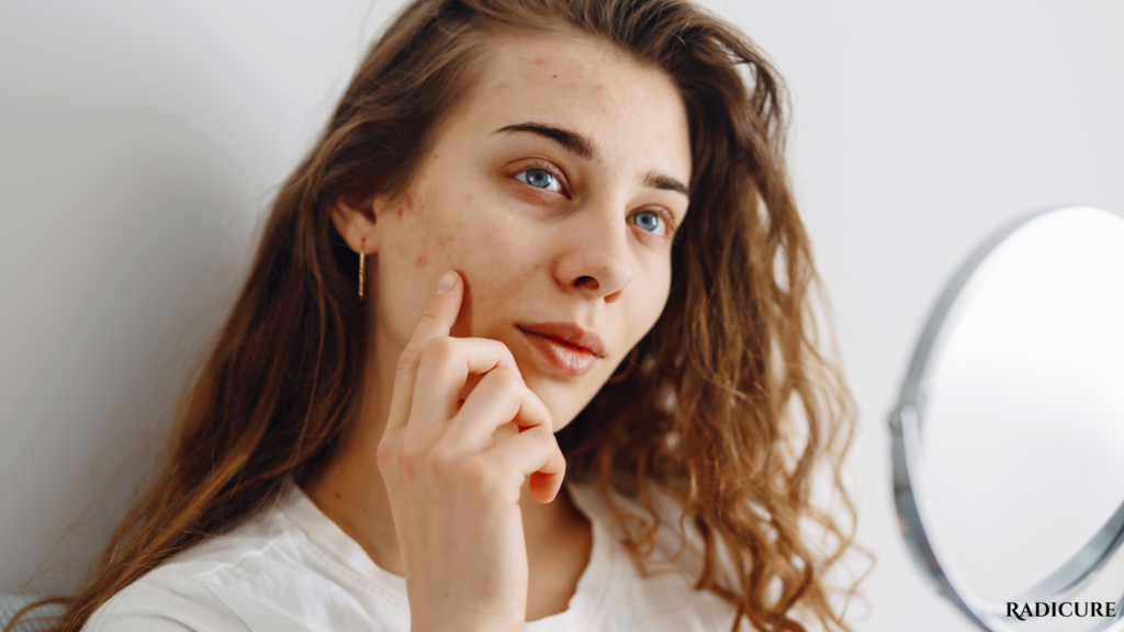 Best Skincare Routine for Dry Skin